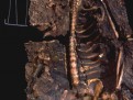 Skeletal Remains with Object - 1993 (detail)